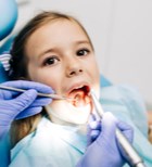 האסתטיקה בקצה החיוך: מטיפול בשן שבורה ועד הלבנת שיניים-תמונה